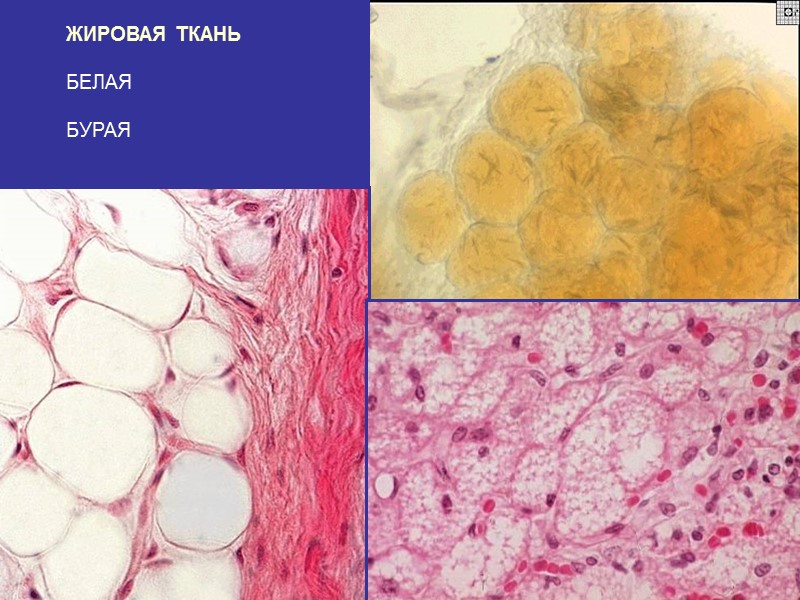 ЖИРОВАЯ ТКАНЬ  БЕЛАЯ  БУРАЯ